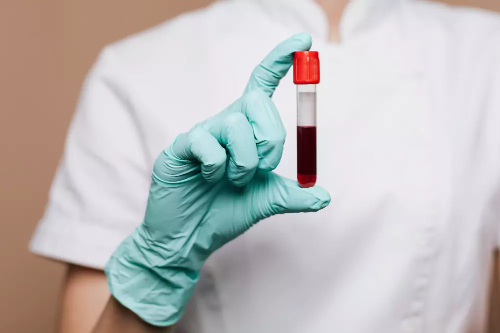 Pathology & Blood Collection